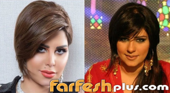 صور نجمات الكويت قبل وبعد عمليات التجميل: لن تصدق التغيير! صورة رقم 17