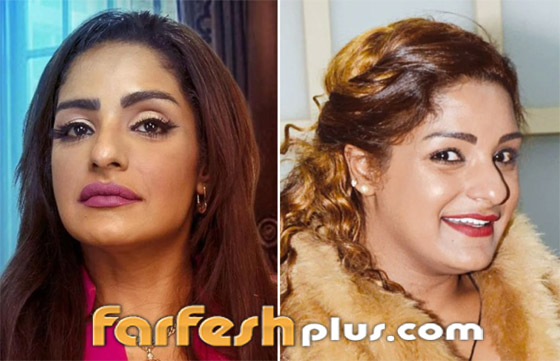 صور نجمات الكويت قبل وبعد عمليات التجميل: لن تصدق التغيير! صورة رقم 22