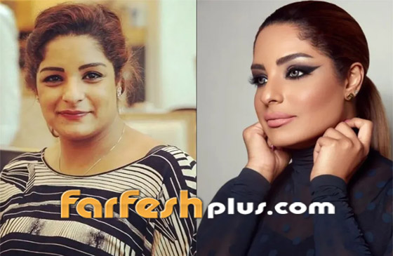 صور نجمات الكويت قبل وبعد عمليات التجميل: لن تصدق التغيير! صورة رقم 8