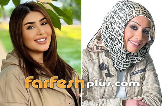 صور نجمات الكويت قبل وبعد عمليات التجميل: لن تصدق التغيير! صورة رقم 2