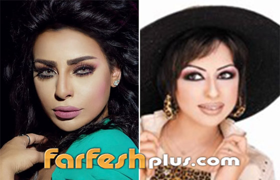 صور نجمات الكويت قبل وبعد عمليات التجميل: لن تصدق التغيير! صورة رقم 13