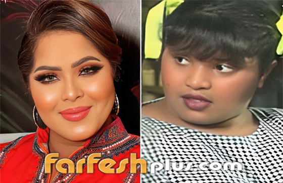 صور نجمات الكويت قبل وبعد عمليات التجميل: لن تصدق التغيير! صورة رقم 19