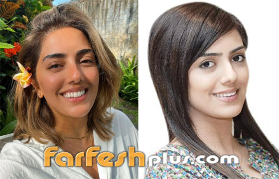 صور نجمات الكويت قبل وبعد عمليات التجميل: لن تصدق التغيير! صورة رقم 14