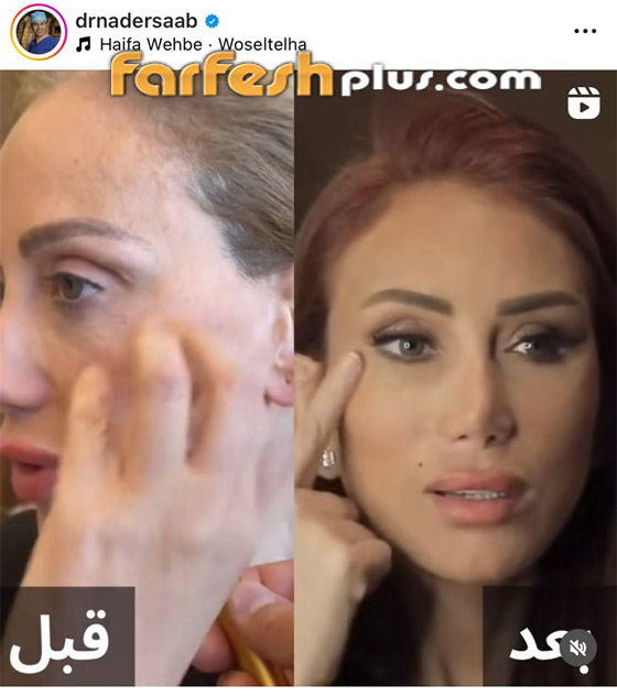 ريهام سعيد تتهم طبيب تجميل لبناني بتشويه وجهها، ونادر صعب يرد مهددا بدعوى صورة رقم 6