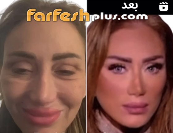 ريهام سعيد تتهم طبيب تجميل لبناني بتشويه وجهها، ونادر صعب يرد مهددا بدعوى صورة رقم 7