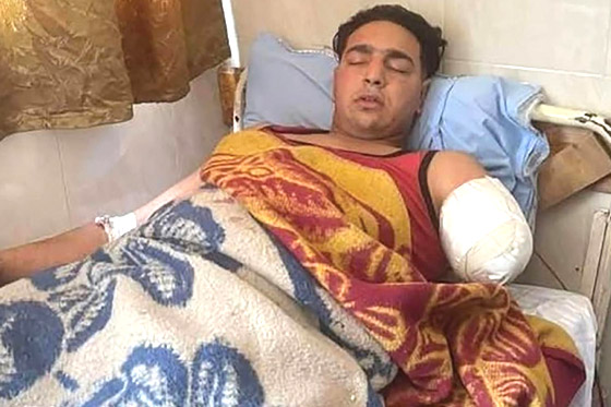 نمر ينهش يد عامل سيرك في مصر صورة رقم 1