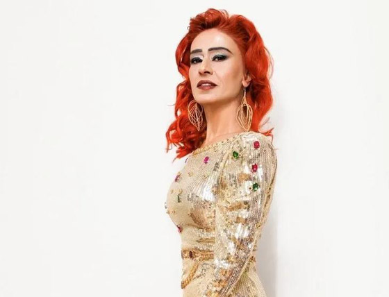 مغنية شهيرة تفاجئ الجمهور وتخلع (باروكتها) على المسرح! ما السبب؟ صورة رقم 3