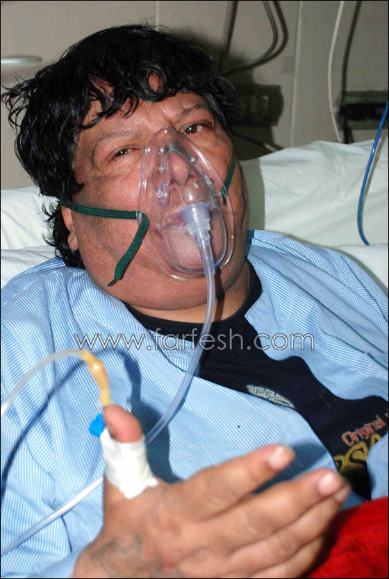 بالصور.. شعبولا في المستشفى نتيجة تجمع مائي على الرئة     صورة رقم 2