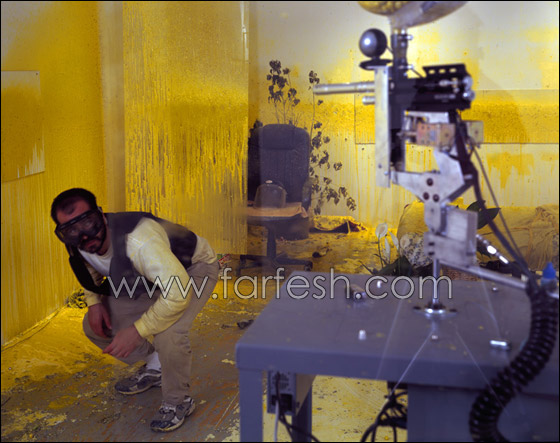 لماذا زرع الفنان وفاء بلال كاميرا صغيرة في مؤخرة رأسه؟! صورة رقم 10 لماذا زرع الفنان وفاء بلال كاميرا صغيرة في مؤخرة رأسه؟! صورة رقم 10