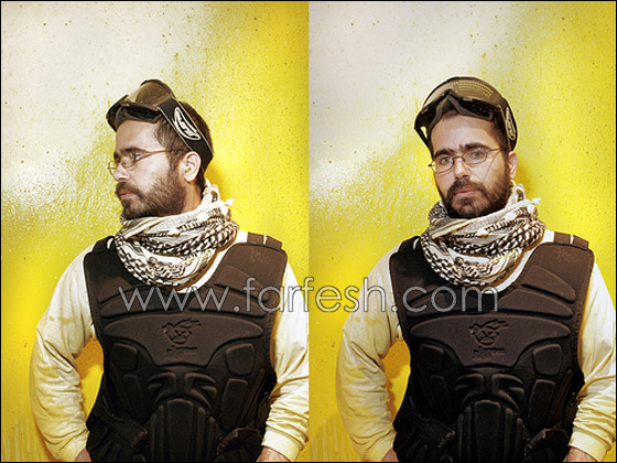 لماذا زرع الفنان وفاء بلال كاميرا صغيرة في مؤخرة رأسه؟! صورة رقم 2 لماذا زرع الفنان وفاء بلال كاميرا صغيرة في مؤخرة رأسه؟! صورة رقم 2