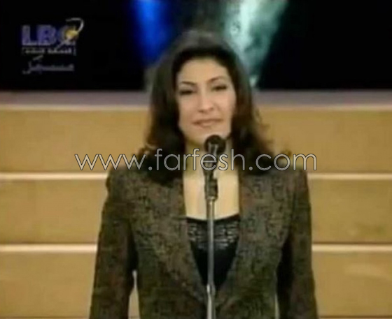 صور يارا قبل وبعد عمليات التجميل.. الفرق هائل! صورة رقم 1