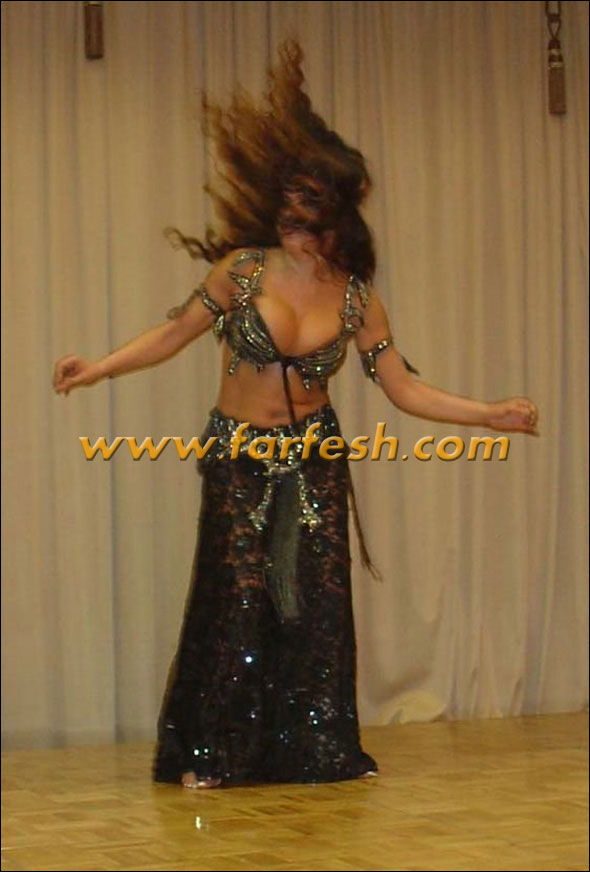 بعد قيامها بحركة خاطئة.. لوسي تخضع لعملية جراحية في ذراعها صورة رقم 12 بعد قيامها بحركة خاطئة.. لوسي تخضع لعملية جراحية في ذراعها صورة رقم 12