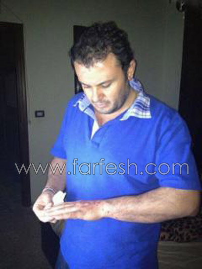 ربيع الاسمر ينجو من حادث سير بعد سقوطه في حفريات صورة رقم 1 ربيع الاسمر ينجو من حادث سير بعد سقوطه في حفريات صورة رقم 1