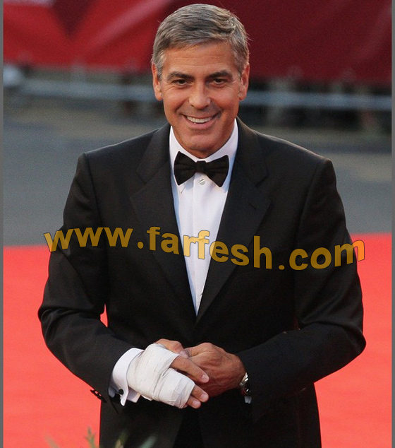 بالطريقة السودانية.. الترحيب بكلوني عن طريق البصق عليه! صورة رقم 5 بالطريقة السودانية.. الترحيب بكلوني عن طريق البصق عليه! صورة رقم 5