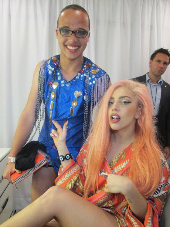 ليدي جاجا تلغي حفلاتها بسبب فخذها صورة رقم 4 ليدي جاجا تلغي حفلاتها بسبب فخذها صورة رقم 4