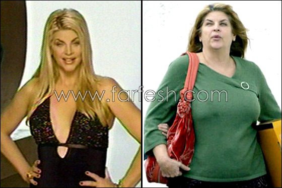 كريستي آلي المثيرة.. قبل وبعد!! صورة رقم 1 كريستي آلي المثيرة.. قبل وبعد!! صورة رقم 1