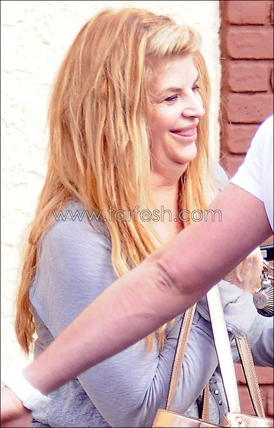 كريستي آلي المثيرة.. قبل وبعد!! صورة رقم 2 كريستي آلي المثيرة.. قبل وبعد!! صورة رقم 2