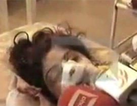 قطع انف زوجته وشفتيها ولاذ بالفرار لانها رفضت الرقص!! صورة رقم 1 قطع انف زوجته وشفتيها ولاذ بالفرار لانها رفضت الرقص!! صورة رقم 1