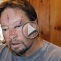 شاهدوا: قط مفترس ينقض على رجل ويشوه وجهه بمخالبه!  	
