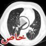اختبر دقة ملاحظتك.. ما الغريب بالصورة؟!! ادخل لتعرف!   	