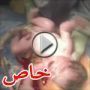 شاهدوا.. لأول مرة تصوير ولادة بعملية قيصرية عبر تويتر 	