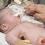 محكمة تلزم والدين بإعطاء رضيعهما ادوية مضادة للفيروسات