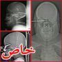 الصور التي اذهلت العالم: نجاة أشخاص من الموت اخترقتهم أدوات حادة