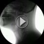 فيديو X-Ray يظهر كيفية عمل فم الانسان أثناء مضغ الطعام