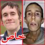 بعد أن جوّع نفسه 4 سنوات وتوقف قلبه 20 دقيقة عاد للحياة متفائلا