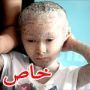 صور صادمة:مرض نادر غطى جسم 