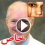 حالة حيرت الاطباء: رجل يبكي دما بدل الدموع
