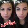 تطبيقات الهواتف الذكية تعطي مسبقا صورة الشخص بعد اجراء عملية جراحية 