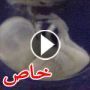 صور وفيديو: اكتشاف جنين متحجر داخل رحم عجوز برازيلية