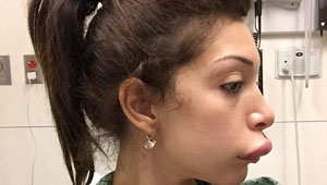 بالصور..عملية تجميل لنجمة امريكية تنتهي بغرفة الطوارئ