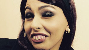 صورة بشعة جدا للفنانة ميس حمدان تصدم جمهورها