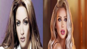 اليكم صور مايا دياب الـ (فاضحة) التي كشفت عمليات التجميل الكثيرة