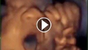 فيديو مذهل.. جنين يحرك شفتيه ويغني وهو في بطن امه