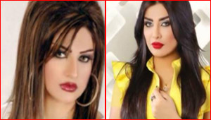 صور امل العوضي قبل وبعد اجراء 7 عمليات تجميل!
