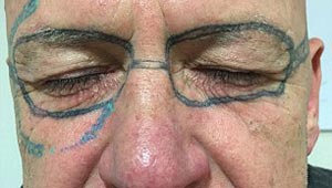 رجل ينام سكرانا ليفاجأ صباحا بوشم محرج على عرض وجهه
