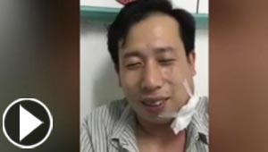 انفجار بطيخة في وجه رجل يتسبب بنقله الى المستشفى.. فيديو