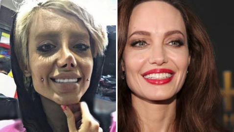 50 عملية تجميل لتشبه أنجيلينا جولي فتحوّلت الى غول وشبه جثة! 