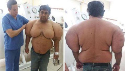 انتفاخ جسم غواص بشكل غريب في حادثة غامضة