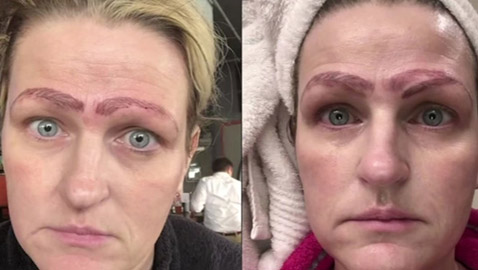 صور صادمة: سيدة خضعت لعملية تجميل لحاجبيها، فخرجت بأربعة حواجب