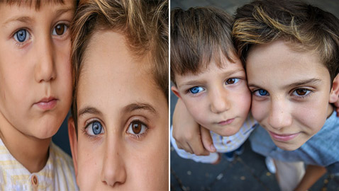 صور: شقيقان لكل منهما عين زرقاء وأخرى بنية والفرق بينهما 7 أعوام