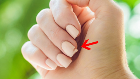 كيف تصلحين الظفر المكسور؟ الخبراء يقدمون لكِ 3 حلول..!